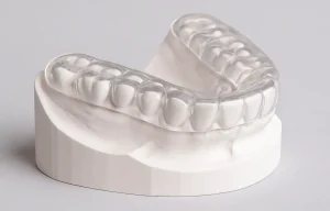 Customized occlusal splints
